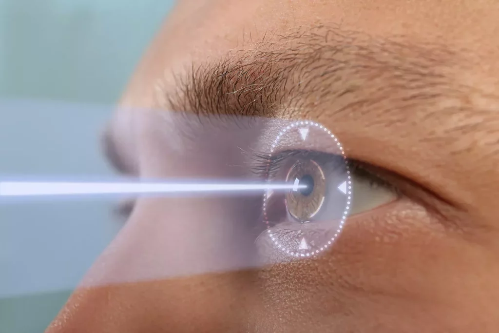 Why LASIK Eye Surgery is a Popular Choice for Vision Correction